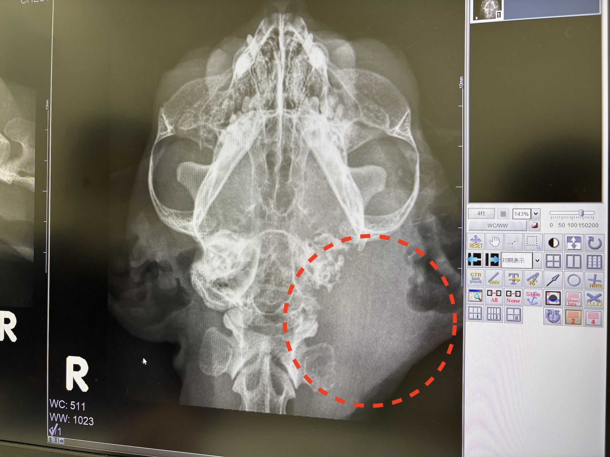 右下の経路が白く塞がっている